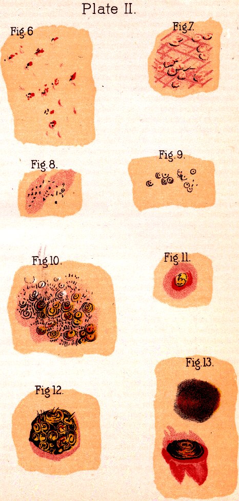 Illustration:
Plate II. Fig. 6. Fig. 7. Fig. 8. Fig. 9. Fig. 10. Fig. 11. Fig. 12. Fig.
13.