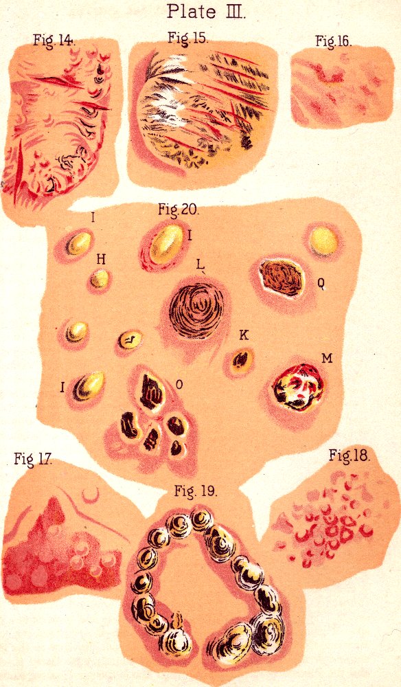 Illustration:
Plate III. Fig. 14. Fig. 15. Fig. 16. Fig. 20. Fig. 17. Fig. 19. Fig. 18.