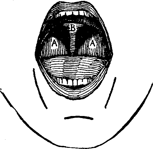 Illustration:
Fig. 17.