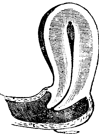 Illustration:
Fig. 9. Conoid Neck.