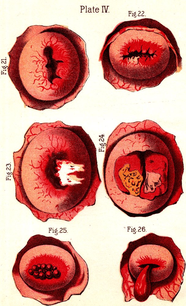 Illustration:
Fig. 22. Fig. 21. Fig. 23. Fig. 24. Fig. 25. Fig. 26.