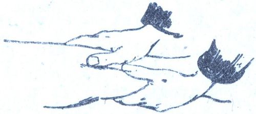 A l&aacute;b vagy a kar massz&iacute;roz&aacute;sa